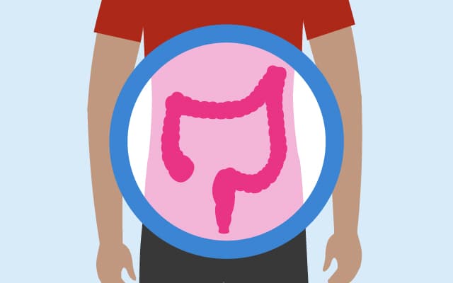 An illustration of the bowel.