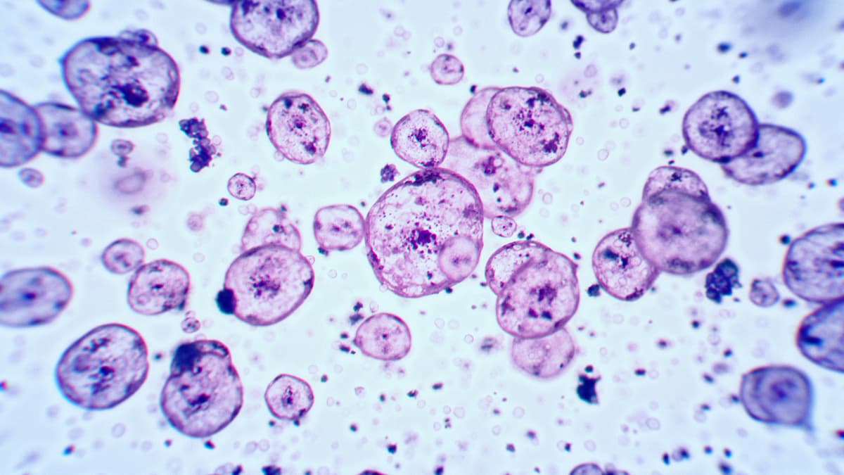 Cell molecules, under a microscope.