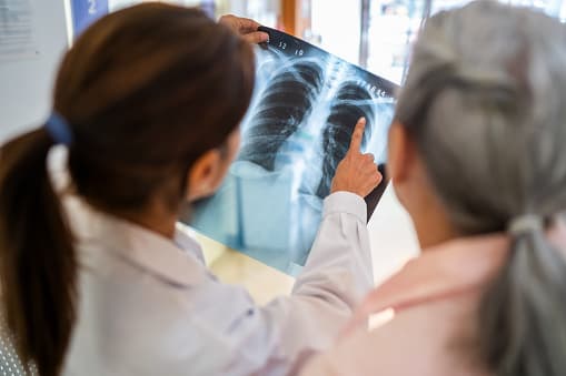 A photo of two health care professionals looking at a lung x ray.