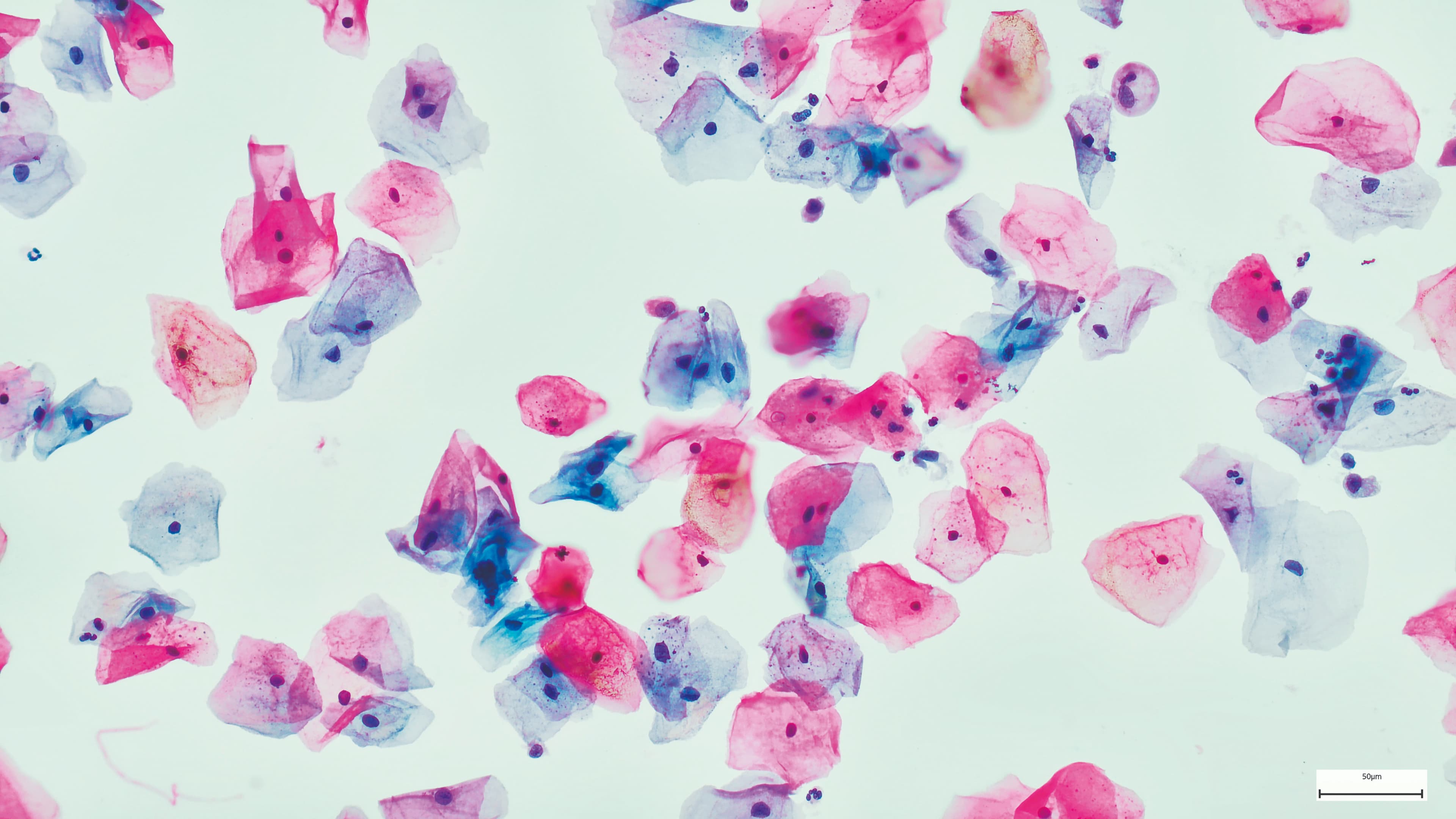 An image of HPV bacteria through a microscope.