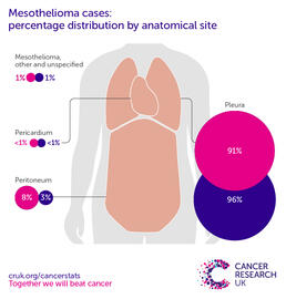 infographic showing the percentage distribution of Mesothelioma incidence by anatomical site