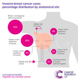 Infographic showing the most common specific location for invasive breast cancers in the UK is the upper-outer quadrant of the breast (2016-2018).