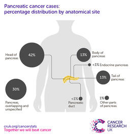 An infographic showing the most common specific location for pancreatic cancers in the UK is the head of the pancreas (2016-2018).