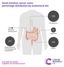 a infographic showing the most common specific location for small intestine cancers in the UK is the duodenum (2016-2018).