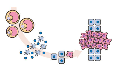 Thumbnail showing how obesity can lead to cancer
