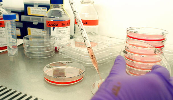 Scientist with culture plate sample