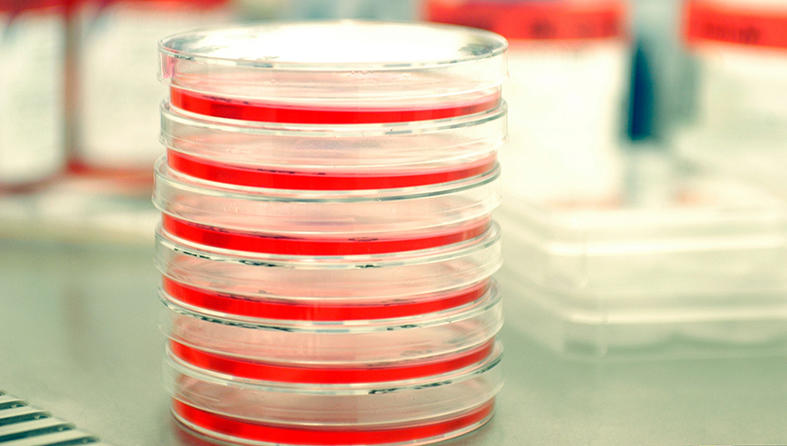 A stack of petri dishes