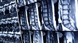 Medical x-rays of the spine