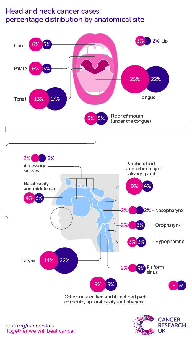 Infographic showing the most common specific location for head and neck cancers in the UK is the tongue (2016-2018).
