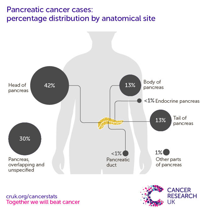 An infographic showing the most common specific location for pancreatic cancers in the UK is the head of the pancreas (2016-2018).
